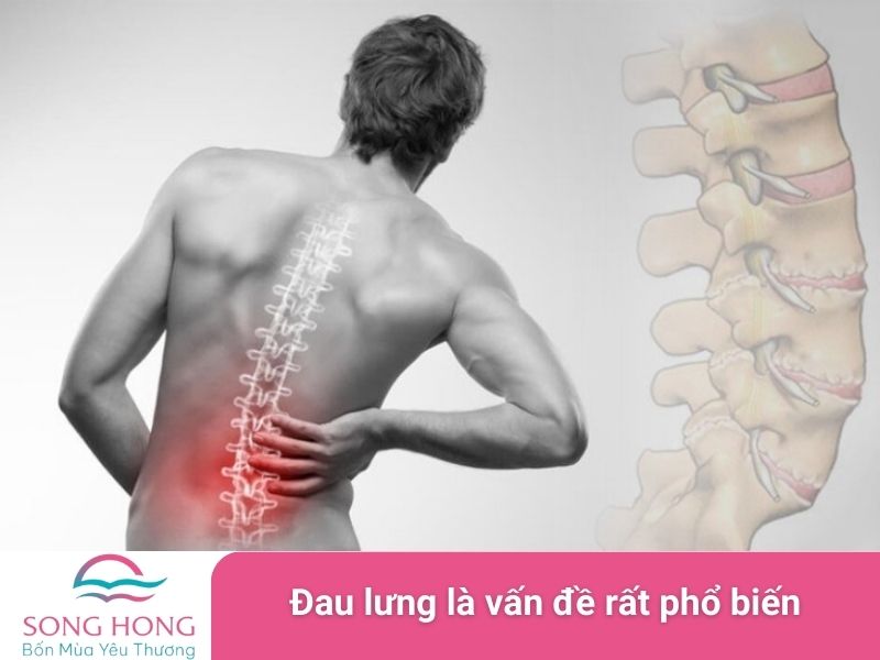 đau lưng là vấn đề rất phổ biến